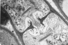 Calypogeia muel Sebacina